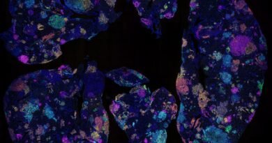 Australian study identifies early blood marker for lung cancer risk