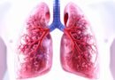 Gujarat sees steady rise in lung cancer cases, tobacco remains key risk factor