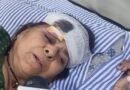 <div>‘Was travelling with my husband… don’t know where he is now’: Victim of Greater Noida bus fire</div>